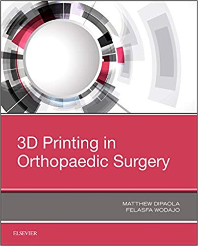 3D Printing in Orthopaedic Surgery by Matthew Dipaola MD , Felasfa M. Wodajo MD 