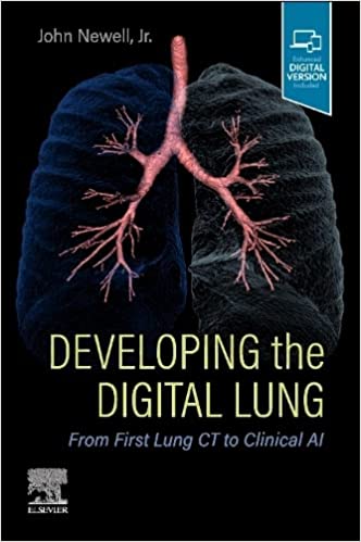 Developing the Digital Lung: From First Lung CT to Clinical AI by John D. Newell MD FACR 