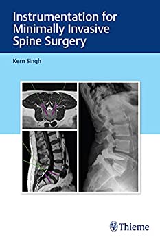 Instrumentation for Minimally Invasive Spine Surgery by Kern Singh
