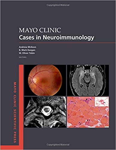 Mayo Clinic Cases In Neuroimmunology By Andrew McKeon , B. Mark Keegan ...