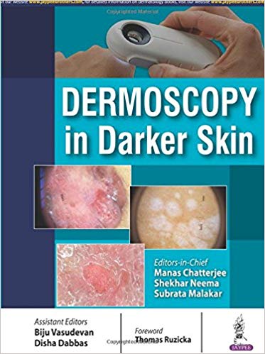 Dermoscopy in Darker Skin by Manas Chatterjee 