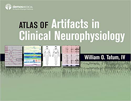 Atlas of Artifacts in Clinical Neurophysiology  by William O., IV, DO Tatum 
