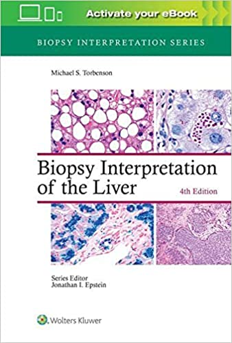 (eBook EPUB)Biopsy Interpretation of the Liver 4th Edition by Michael Torbenson MD 