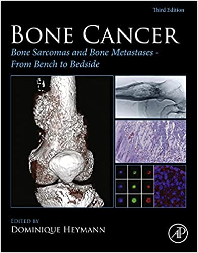Bone Cancer: Bone Sarcomas and Bone Metastases - From Bench to Bedside 3rd Edition by Dominique Heymann 