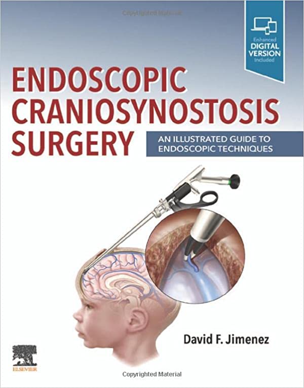 Endoscopic Craniosynostosis Surgery: An Illustrated Guide to Endoscopic Techniques 1st Edition by David F. Jimenez 