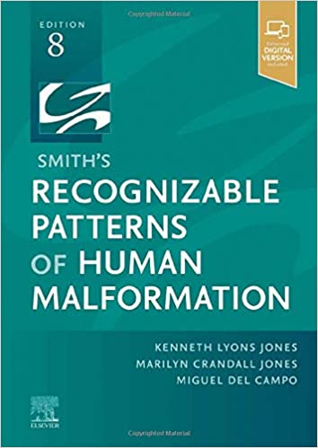 Smith s Recognizable Patterns of Human Malformation - E-Book 8th edition by Kenneth Lyons Jones MD , Marilyn Crandall 