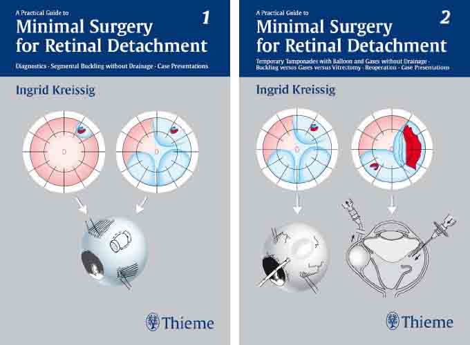 A Practical Guide to Minimal Surgery for Retinal Detachment, Volume I and 2 by Ingrid Kreissig 