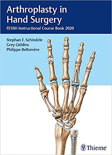 Arthroplasty in Hand Surgery: Fessh Instructional Course Book 2020 1st Edition by Stephan F. Schindele , Grey Giddins , Philippe Bellemère 