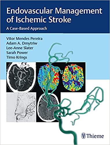 Endovascular Management of Ischemic Stroke: A Case-Based Approach 1st Edition by Vitor Mendes Pereira , Adam A. Dmytriw , Lee-Anne Slater 