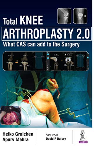 [PDF]Total Knee Arthroplasty 2.0 [Print Replica] Kindle Edition by Apurv Mehra