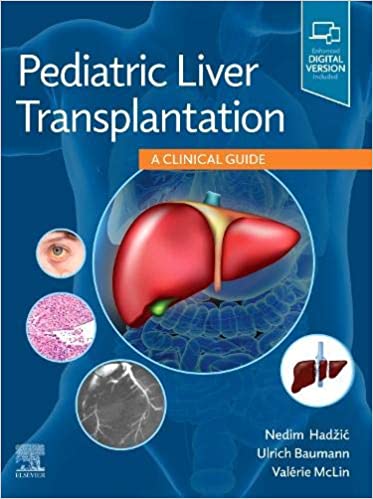 Pediatric Liver Transplantation: A Clinical Guide 1st Edition by Nedim Hadzic , Ulrich Baumann, Valérie MCLIN 