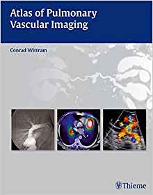 Atlas of Pulmonary Vascular Imaging by Conrad Wittram 