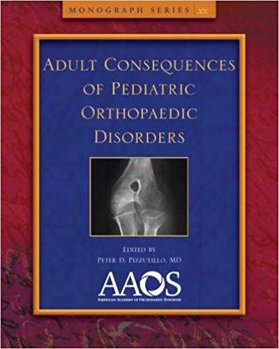 Adult Consequences of Pediatric Orthopaedic Conditions by Peter D. Pizzutillo , Martin J. Herman 