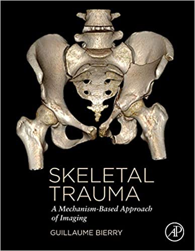 Skeletal Trauma A Mechanism-Based Approach of Imaging by Guillaume BIERRY 