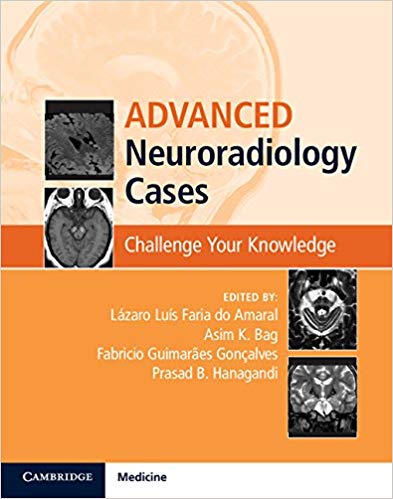 Advanced Neuroradiology Cases by Lázaro Luís Faria do Amaral , Asim K. Bag , Fabrício Guimarães Gonçalves , Prasad B. Hanagandi 