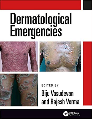 Dermatological Emergencies  by Rajesh Verma , Biju Vasudevan 