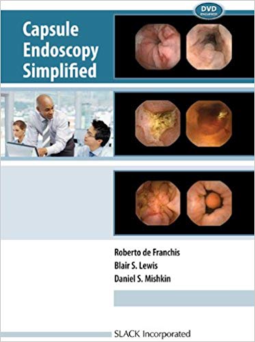 Capsule Endoscopy Simplified by Roberto DeFranchis MD , Blair S. Lewis MD , Daniel S. Mishkin MD CM 