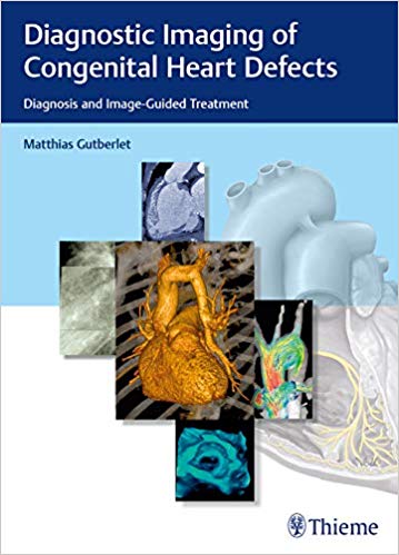 Diagnostic Imaging of Congenital Heart Defects by Matthias Gutberlet 
