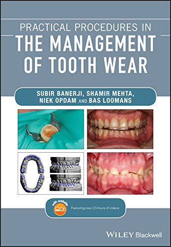 Practical Procedures in the Management of Tooth Wear by Subir Banerji , Shamir B. Mehta , Niek Opdam , Bas Loomans 