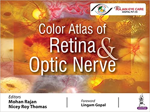 Color Atlas of Retina and Optic Nerve by Mohan Rajan , Nicey Roy Thomas 