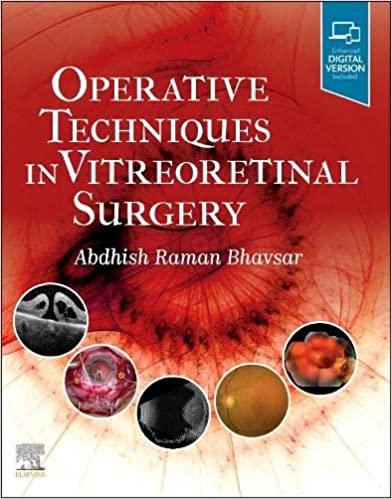 Operative Techniques in Vitreoretinal Surgery by Abdhish R. Bhavsar MD 
