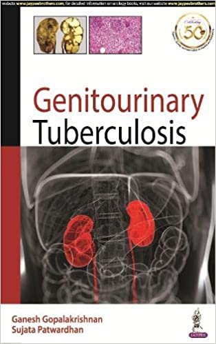 Genitourinary Tuberculosis by Ganesh Gopalakrishnan , Sujata Patwardhan 