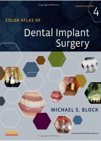Color Atlas of Dental Implant Surgery, 4th Edition by Michael S. Block