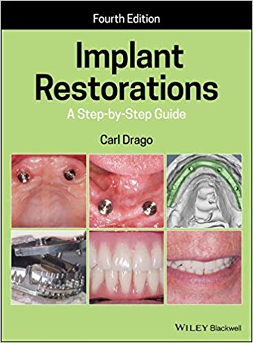 Implant Restorations A Step-by-Step Guide 4th Edition by Carl Drago 