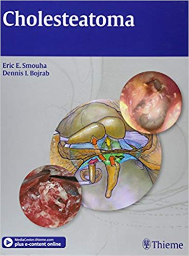 Cholesteatoma  by Eric E. Smouha , Dennis I. Bojrab 