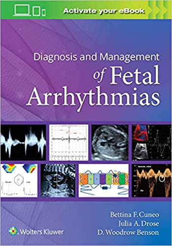 (eBook HTML)Diagnosis and Management of Fetal Arrhythmias Illustrated Edition by Bettina Cuneo , Julia Drose , D. Woodrow Benson 