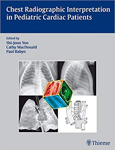 Chest Radiographic Interpretation in Pediatric Cardiac Patients (Rare) by Shi-Joon Yoo , Cathy MacDonald , Paul Babyn 