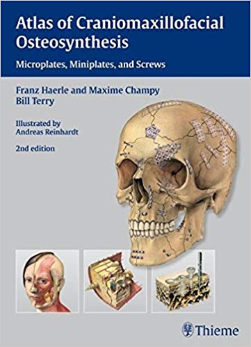 Atlas of Craniomaxillofacial Osteosynthesis by Franz Härle , Maxime Champy , Bill Terry 