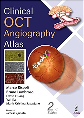 Clinical OCT Angiography Atlas 2nd Edition by Marco Rispoli , Bruno Lumbroso , David Huang , Yali Jia , Maria Cristina Savastano 