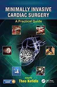 Minimally Invasive Cardiac Surgery: A Practical Guide by Theo Kofidis
