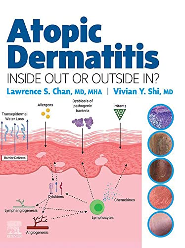 Atopic Dermatitis: Inside Out or Outside In by Lawrence S Chan , Vivian Y. Shi 