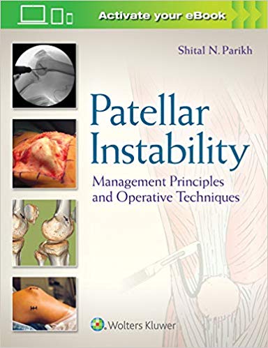 Patellar Instability Management Principles and Operative Techniques by Dr. Shital N Parikh MD 