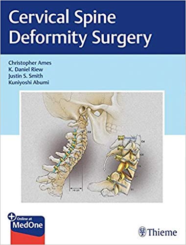 Cervical Spine Deformity Surgery by Christopher Ames , K. Daniel Riew , Justin Smith , Kuniyoshi Abumi 