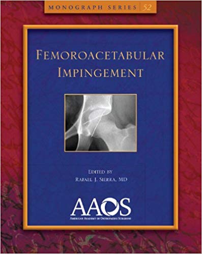 Femoroacetabular Impingement by Rafael J Sierra MD 