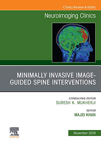 Spine Intervention, An Issue of Neuroimaging Clinics of North America, Ebook (The Clinics: Radiology 29) 1st Edition by Majid Khan 