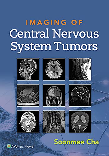 (eBook EPUB)Imaging of Central Nervous System Tumors by Soonme Cha 