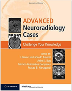 Advanced Neuroradiology Cases: Challenge Your Knowledge, 1e  by  Lázaro Luís Faria do Amaral