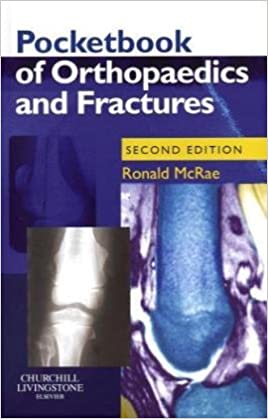 Pocketbook of Orthopaedics and Fractures, 2nd Edition