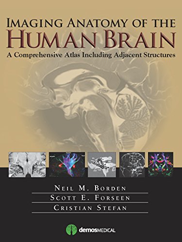 Imaging Anatomy of the Human Brain: A Comprehensive Atlas Including Adjacent Structures by Neil M. Borden MD