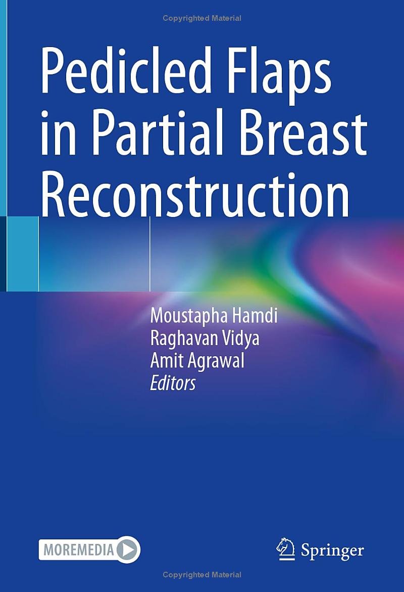 Pedicled Flaps in Partial Breast Reconstruction 1st by  Moustapha Hamdi , Raghavan Vidya 
