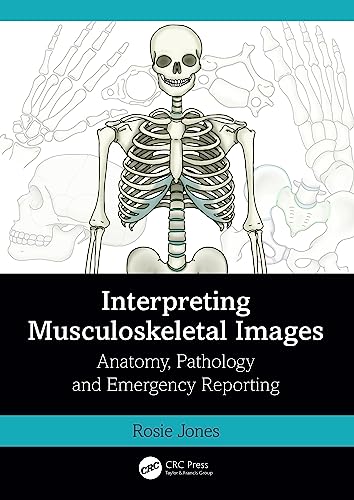 Interpreting Musculoskeletal Images: Anatomy, Pathology and Emergency Reporting  by Rosie Jones 