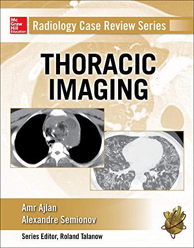 Radiology Case Review Series: Thoracic Imaging 