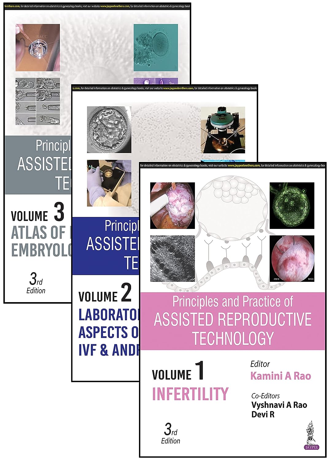 Principles and Practice of Assisted Reproductive Technology (3 Volumes), 3rd edition  by  Kamini A Rao