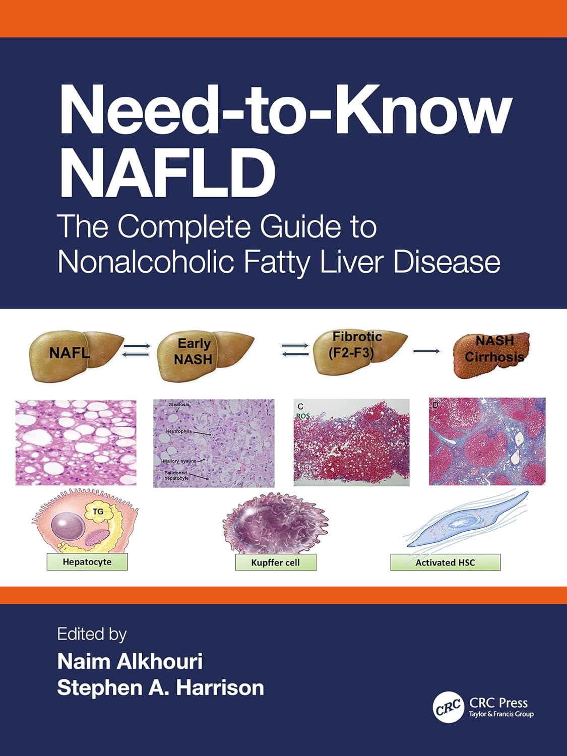 Need-to-Know NAFLD: The Complete Guide to Nonalcoholic Fatty Liver Disease  by Naim Alkhouri 