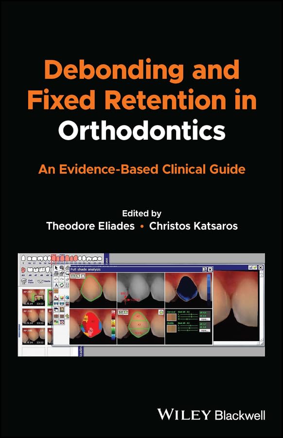 Debonding and Fixed Retention in Orthodontics: An Evidence-Based Clinical Guide  by Theodore Eliades