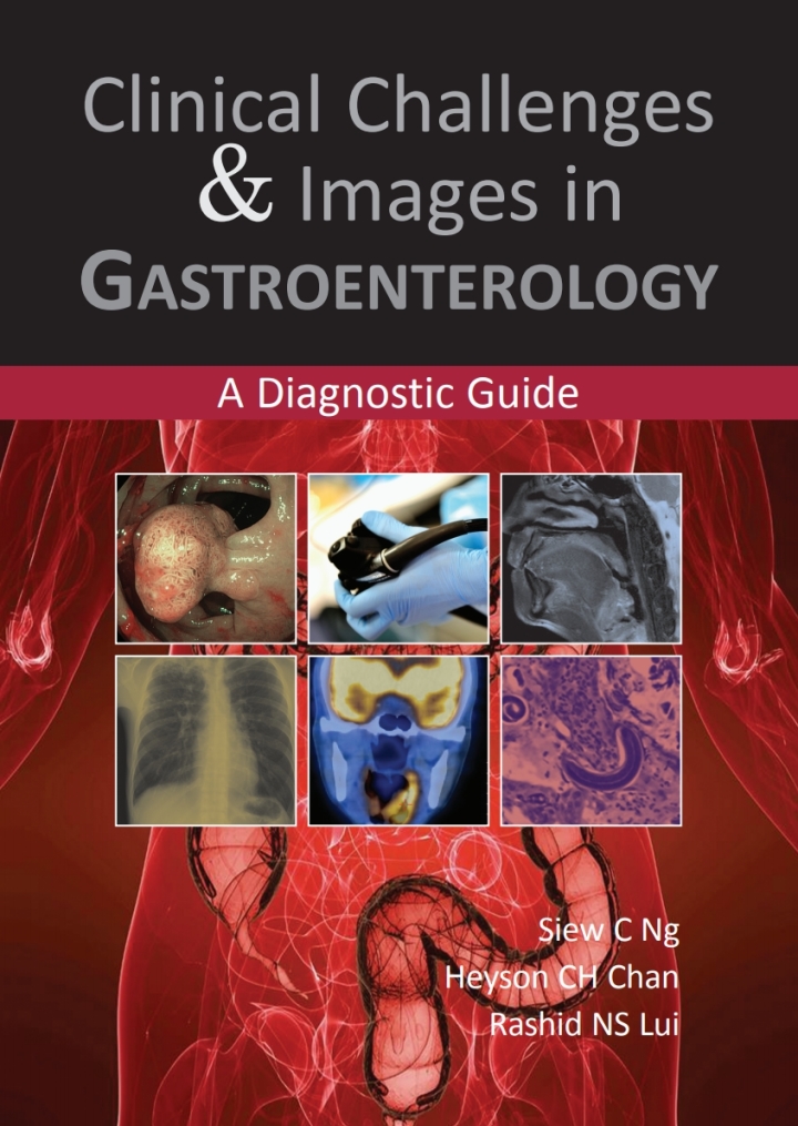 Clinical Challenges  and  Images in Gastroenterology 